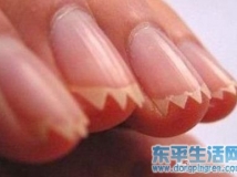 如果你女友把腳弄成這樣,，你會怎么辦,？